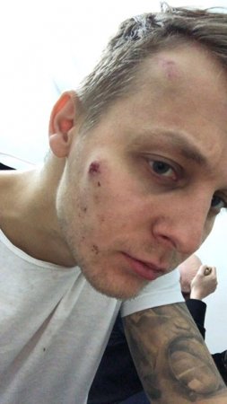 В столичном Киева избили старшего сына Шуфрича