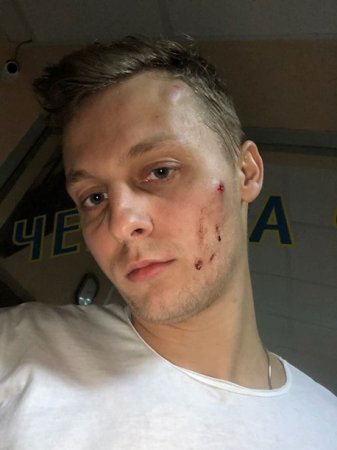 В столичном Киева избили старшего сына Шуфрича