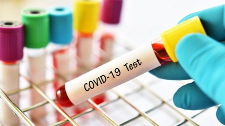 В Украина заработал закон об усиленном тестировании на COVID-19