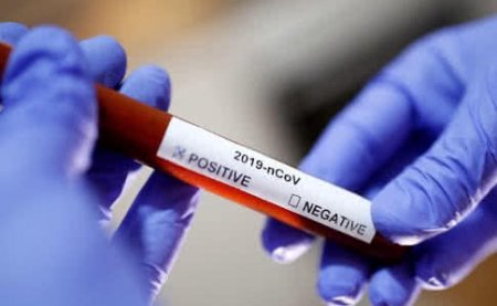 В Украине впервые провели более 5 тыс. ПЦР тестов на коронавирус за сутки, - Максим Степанов